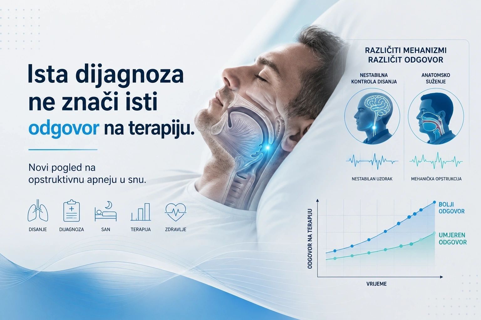 Novi pogled na opstruktivnu apneju u snu — ilustracija